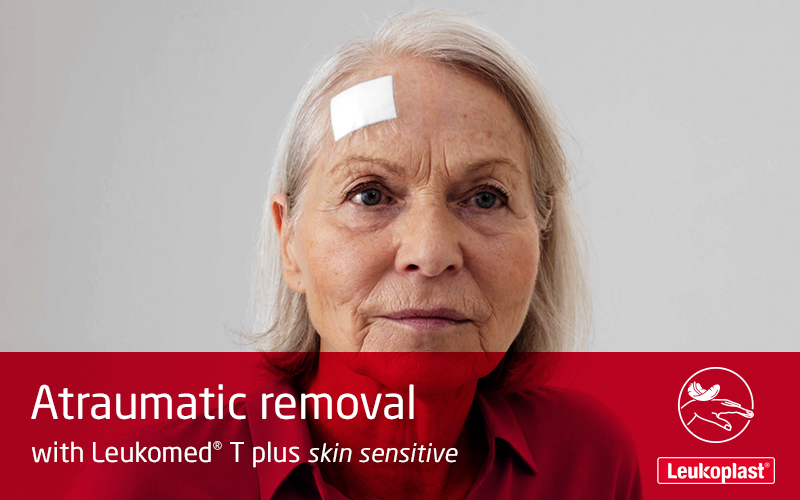 Denne video demonstrerer, hvordan forbindinger kan fjernes fra skrøbelig hud uden skin tears. En sundhedsperson viser smertefri fjernelse af en Leukomed T plus skin sensitive-forbinding fra en ældre kvindes pande. Denne video demonstrerer, hvordan forbindinger kan fjernes fra skrøbelig hud uden skin tears. En sundhedsperson viser smertefri fjernelse af en Leukomed T plus skin sensitive-forbinding fra en ældre kvindes pande.